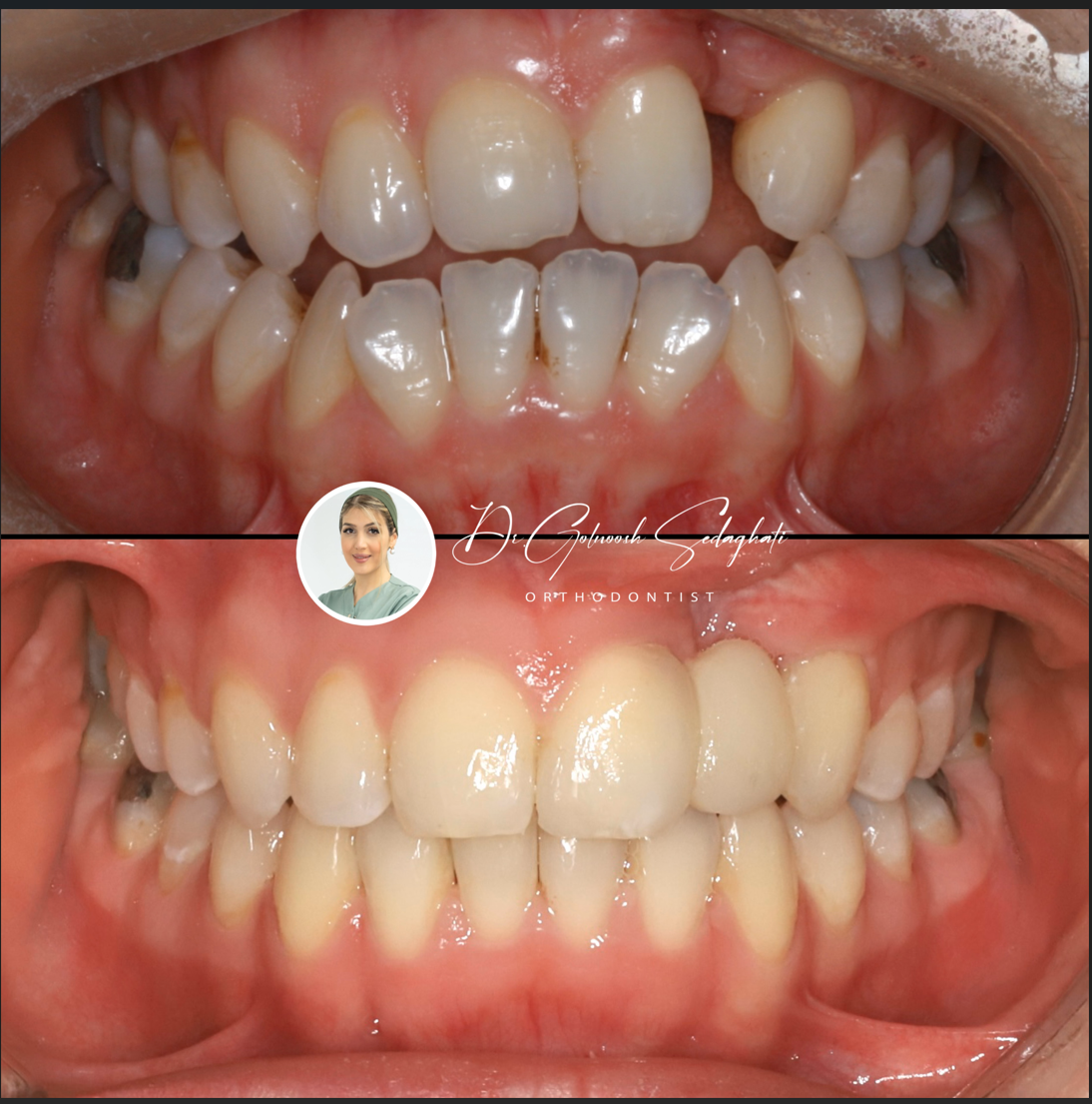 #دکتر-گلنوش-صداقتی-دندان-پزشکی #متخصص-ارتودنسی