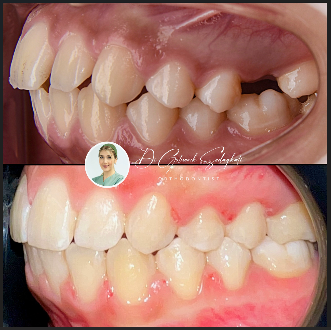 #دکتر-گلنوش-صداقتی-دندان-پزشک #متخصص-ارتودنسی